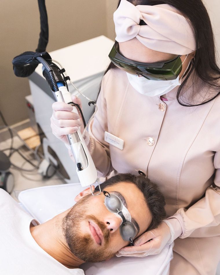Depilação a laser de faixa de barba masculina