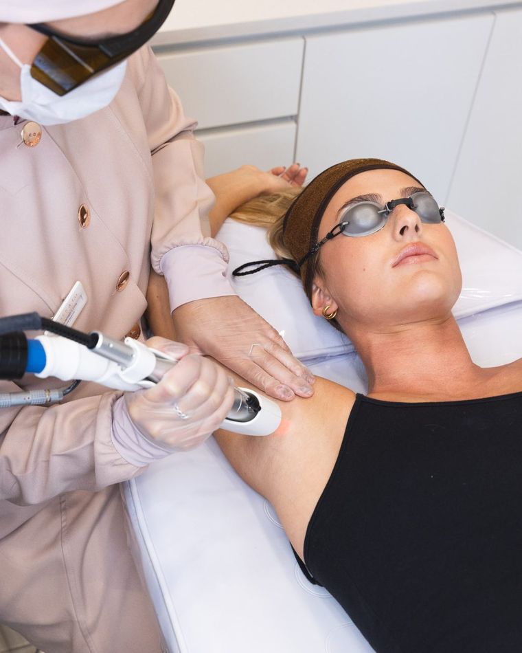 Depilação a laser de buço e rosto